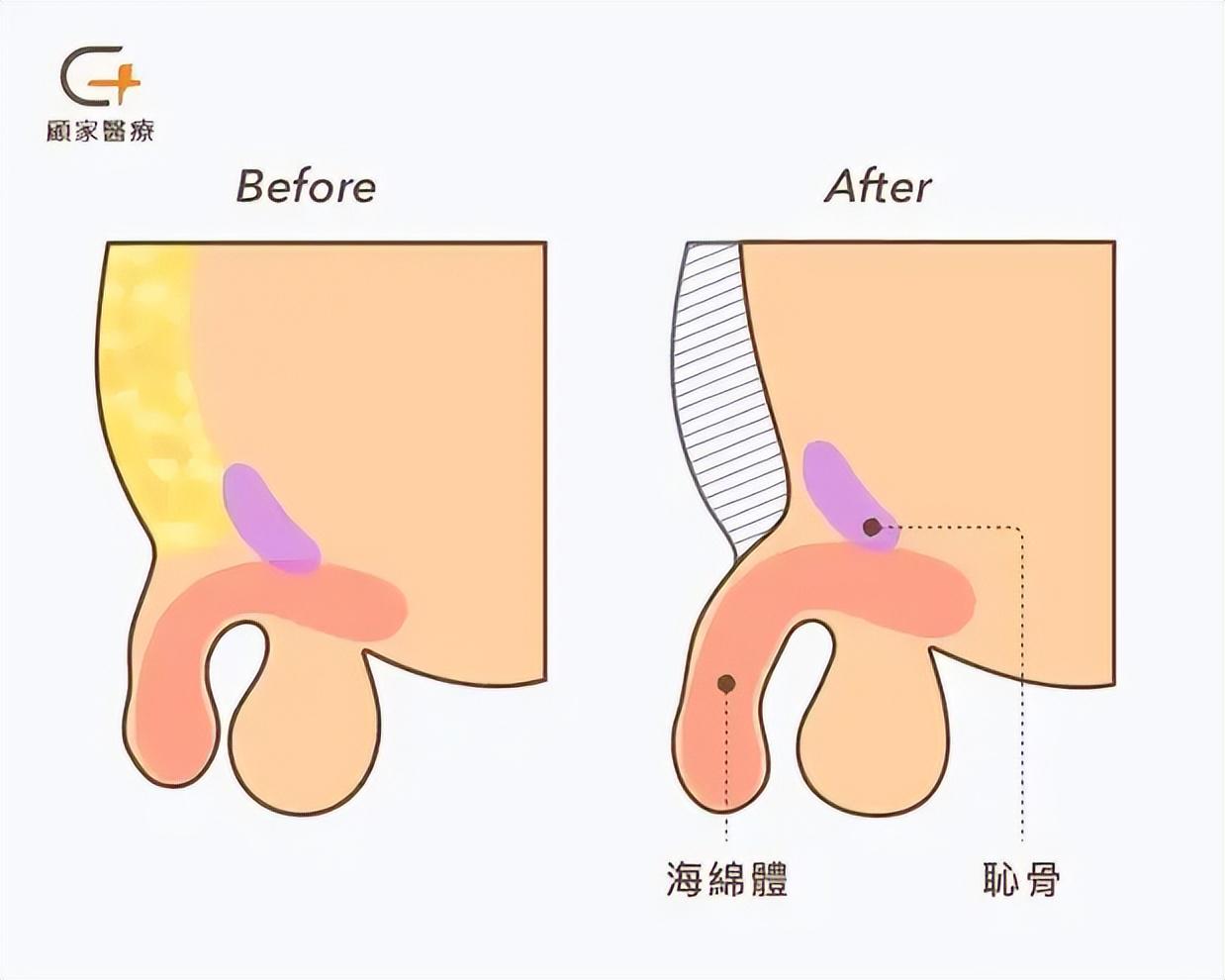 马德兴：自媒体兴起让小球员拥有巨大关注度，也侵蚀了专注度